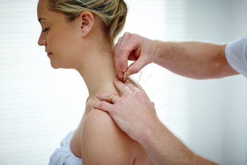 Manage Chronic Pain with Acupuncture in Orange CA Manage Chronic Pain with Acupuncture in Orange CA