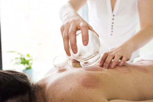 Cupping Specialist