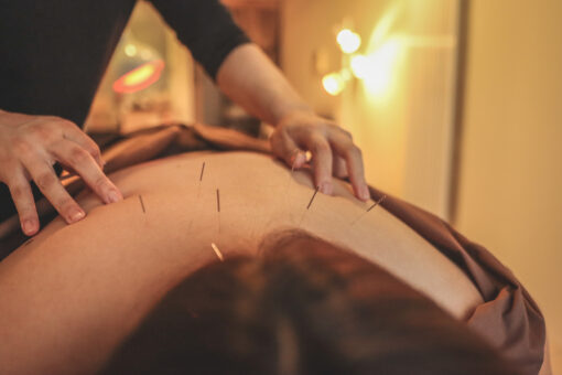 Acupuncture for menstrual cramps and PMS in Orange, CA