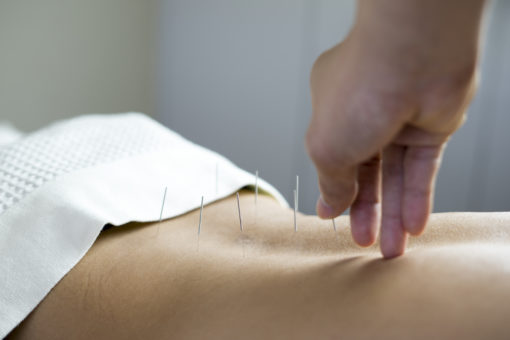 Acupuncture for Menstrual Cramps and PMS