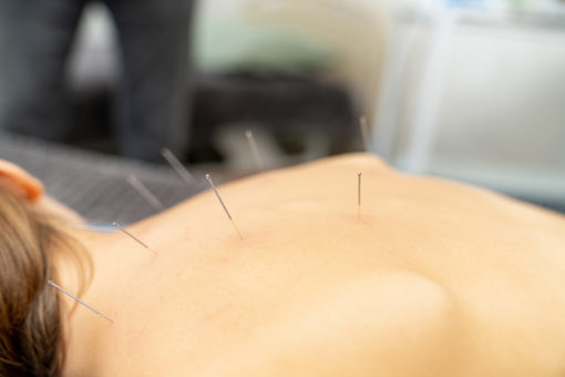 Acupuncture Specialist in Orange, California