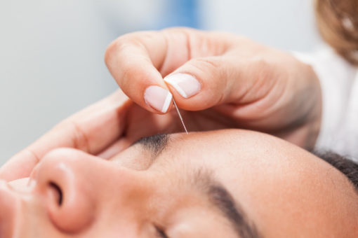 Acupuncture for College Students in Orange, California