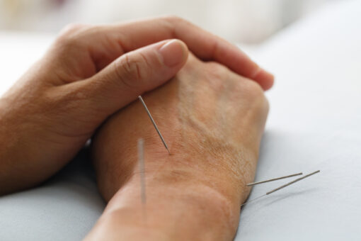 HOW DOES ACUPUNCTURE TREAT REPETITIVE MOTION DISORDERS?